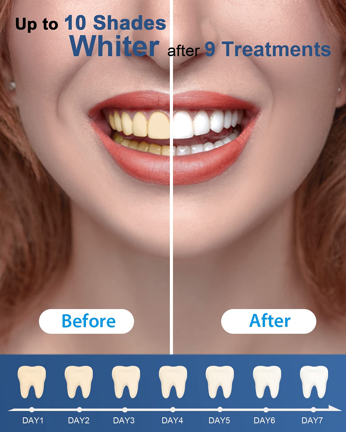 MySmile kit en neceser durante viaje para mantenimiento práctico del blanqueado