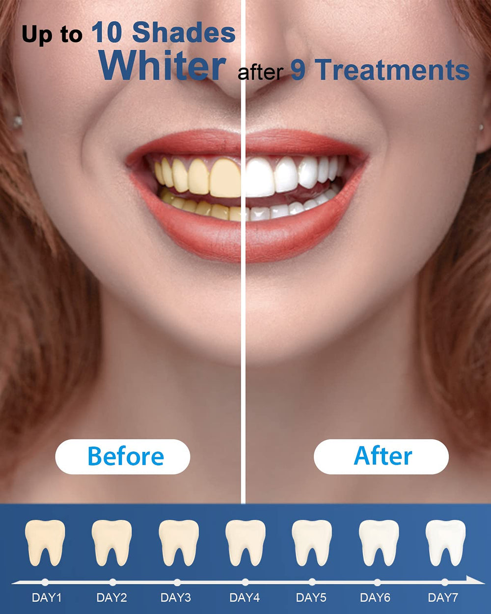 MySmile kit en neceser durante viaje para mantenimiento práctico del blanqueado