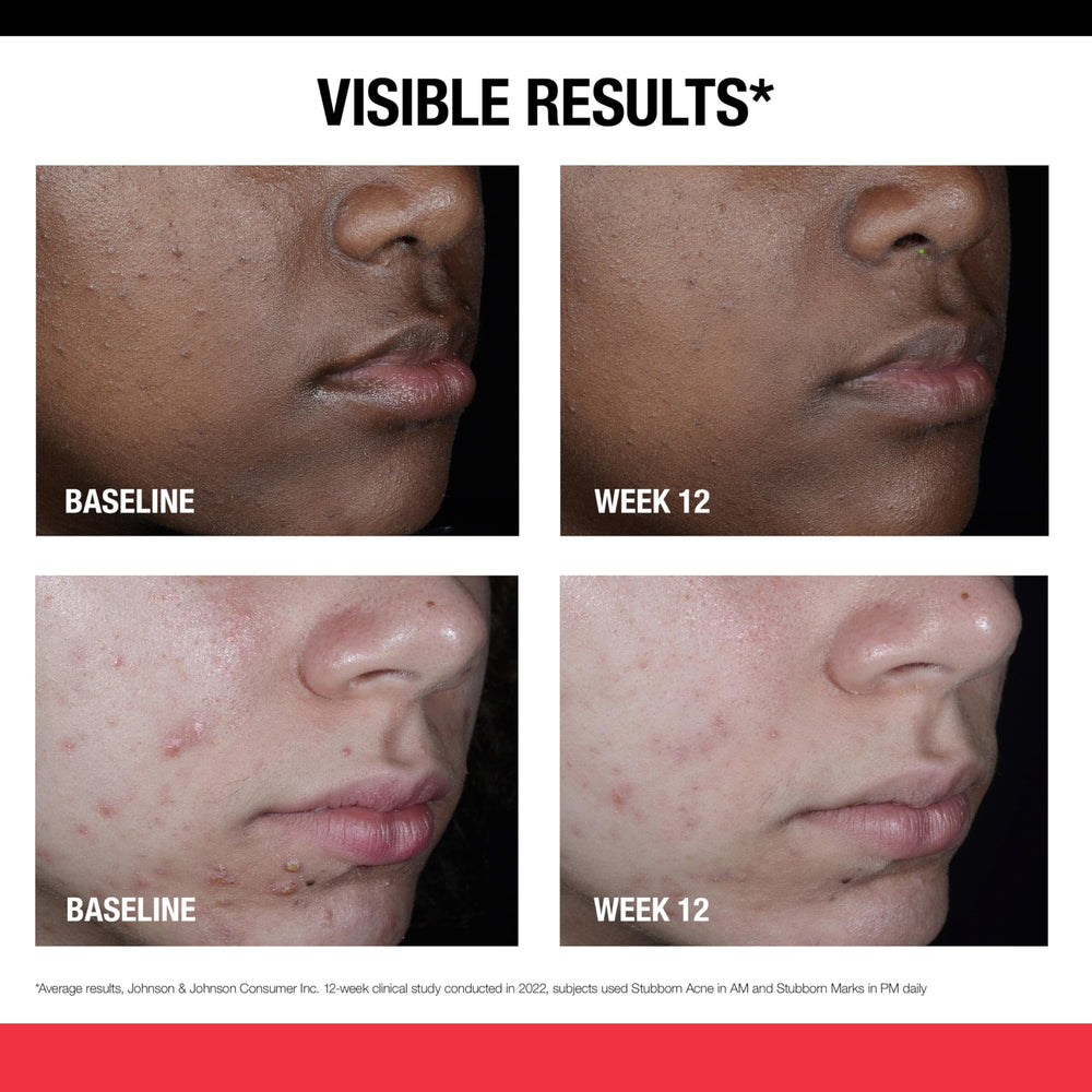 Neutrogena aplicación nocturna en rostro para renovar piel mientras duermes