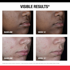 Neutrogena aplicación nocturna en rostro para renovar piel mientras duermes