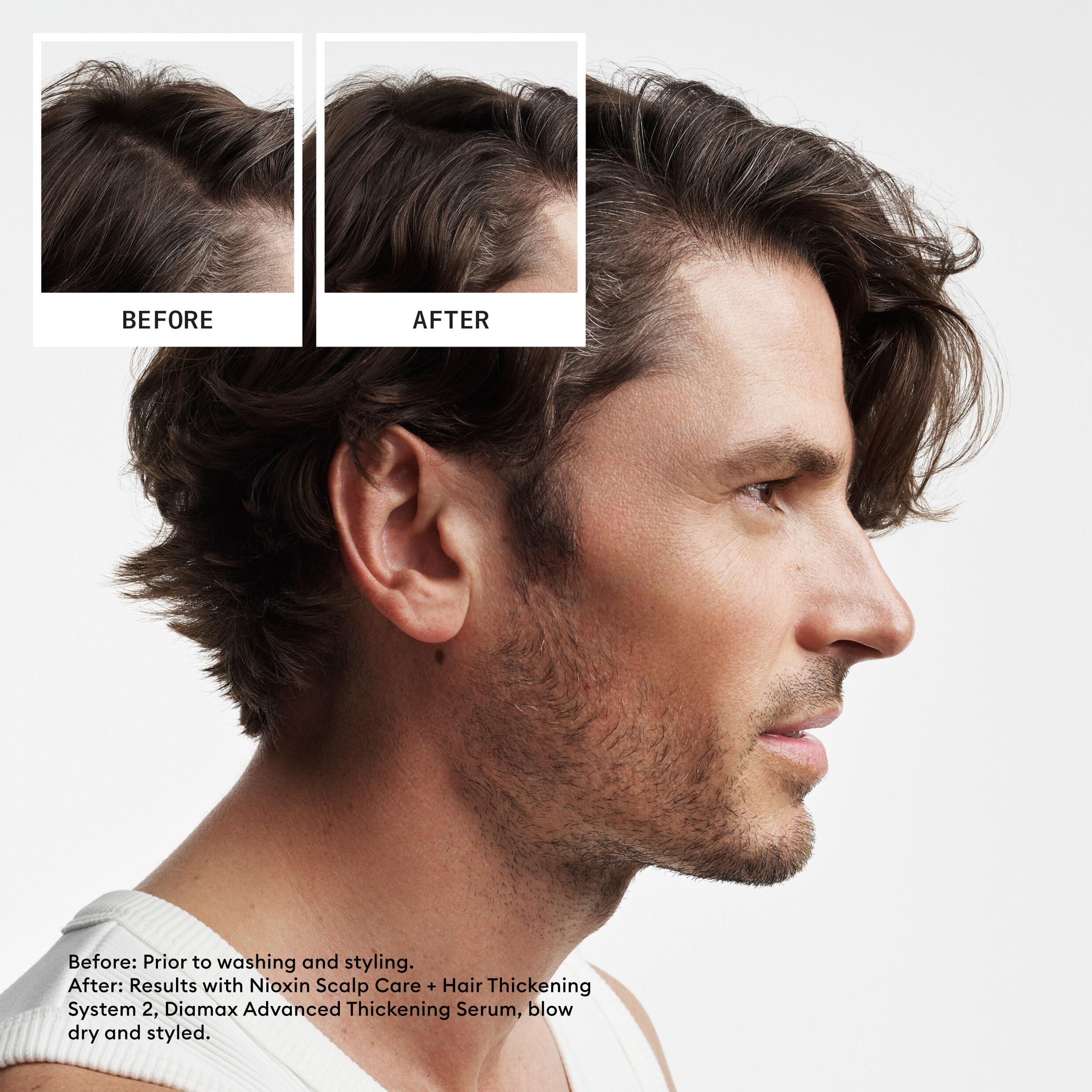 Nioxin cleanser close-up texture removing buildup for healthier scalp