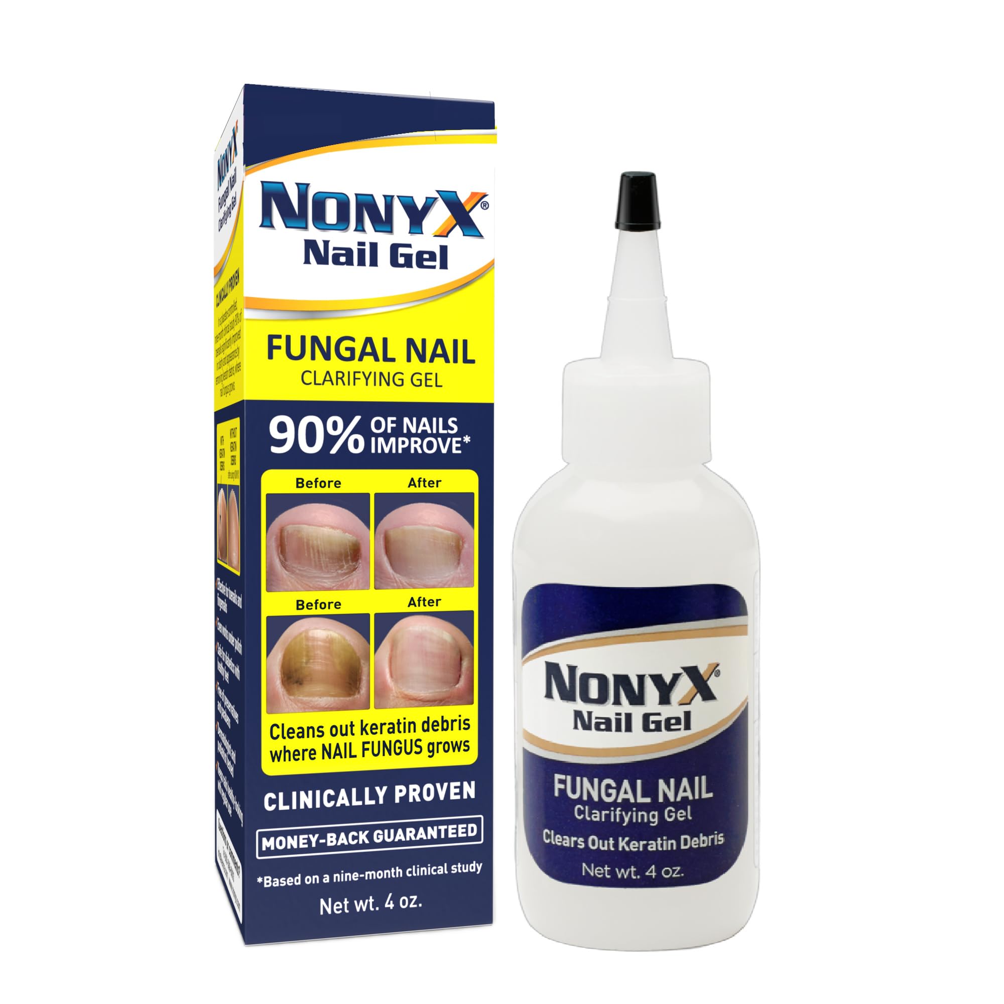 NONYX frasco frontal mostrando etiqueta y tamaño, fácil identificación y uso