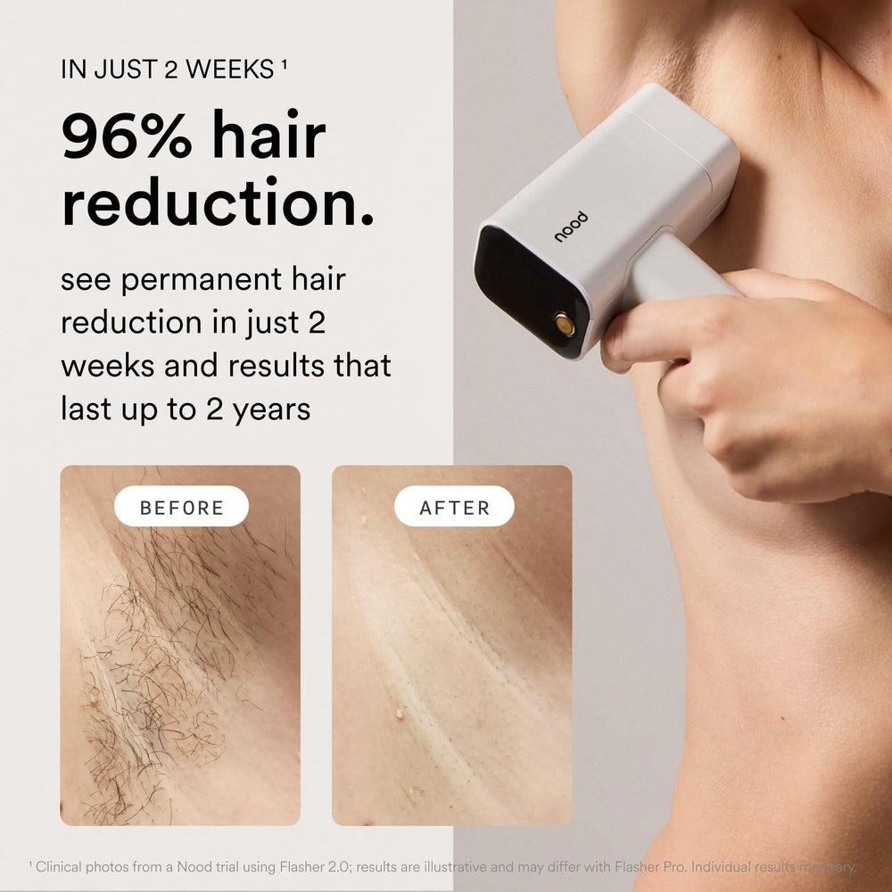 Nood Flasher Pro textura del mango que asegura buen agarre