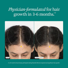 Nutrafol mujer tomando suplemento en su rutina diaria para apoyar cabello