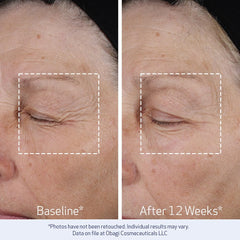 Obagi ELASTIderm etiqueta con ingredientes clave para transparencia y confianza