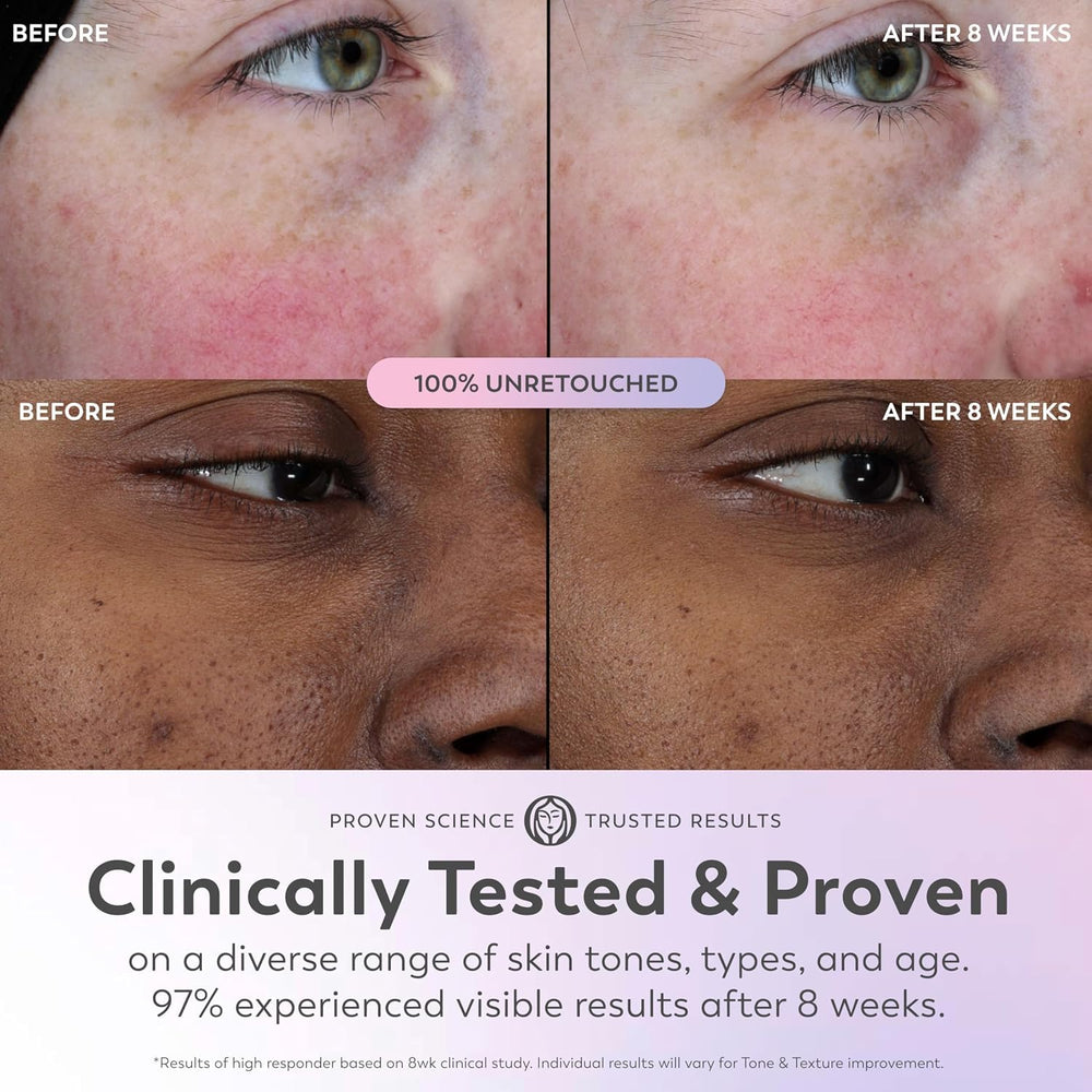 Olay Super Serum sosteniéndose en mano, packaging fácil de usar y dosificar