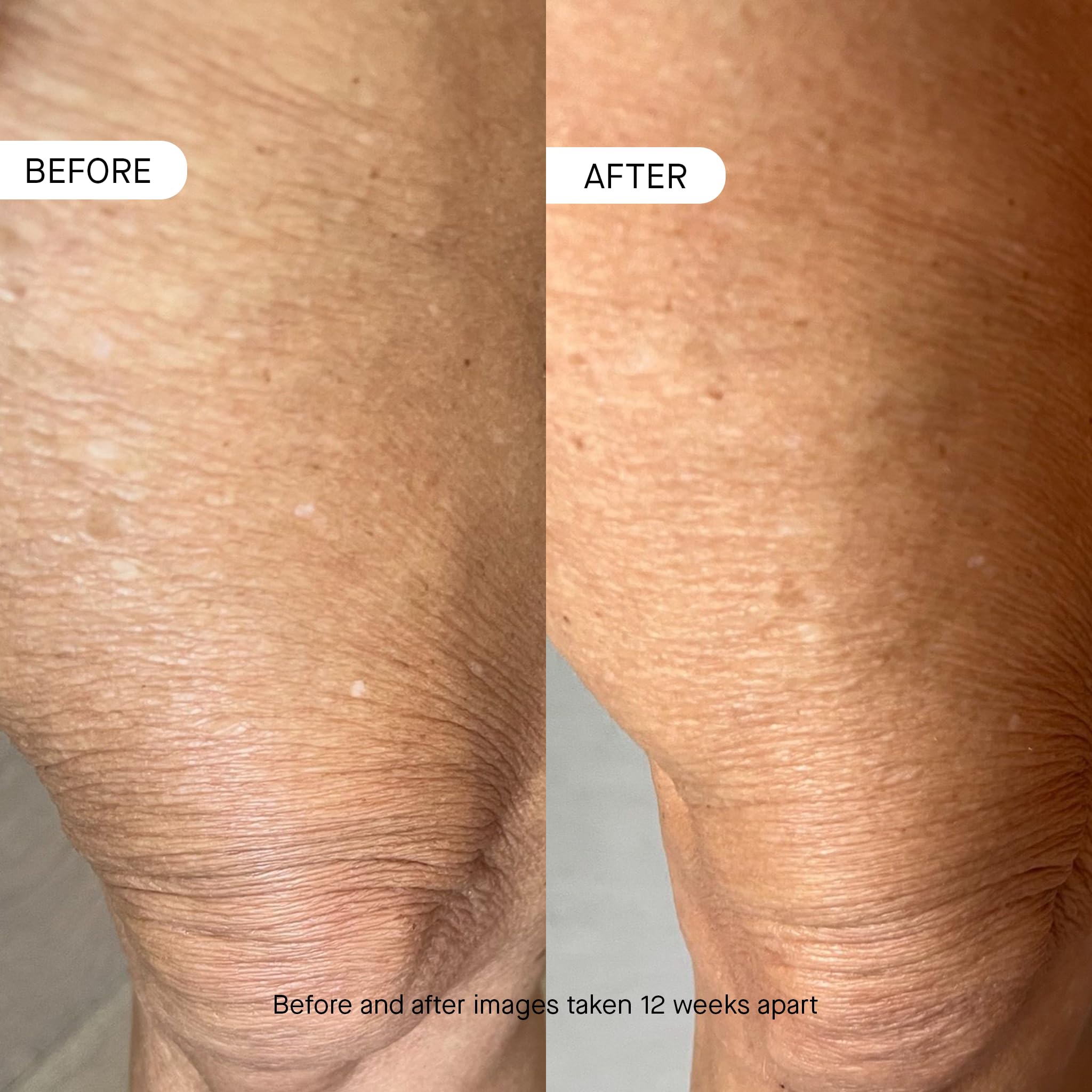 oneskin frasco junto a objetos para escala, beneficio claridad de tamaño