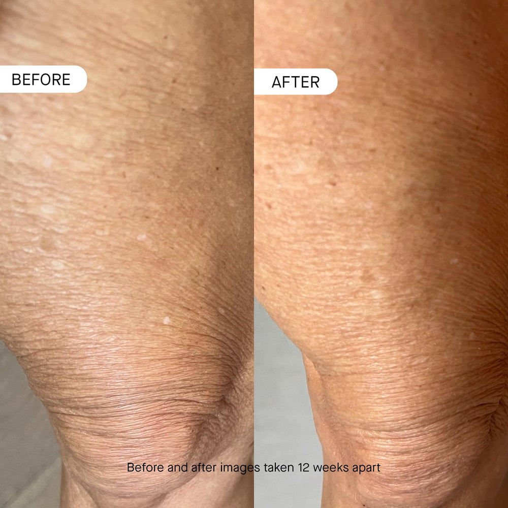 oneskin frasco junto a objetos para escala, beneficio claridad de tamaño
