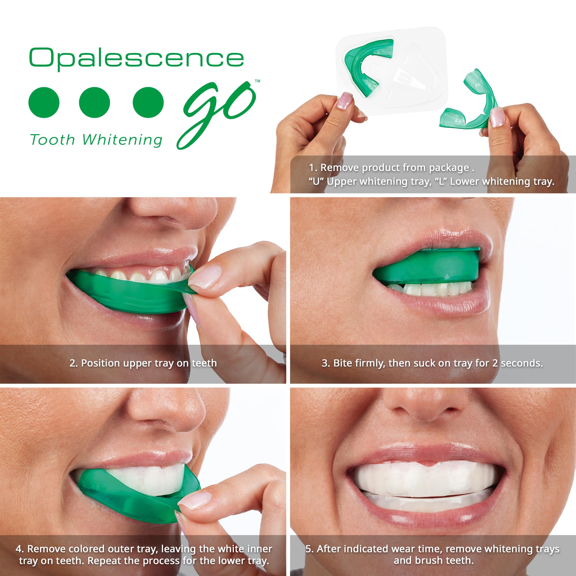 Detalle de bandeja UltraFit Opalescence que se adapta a la sonrisa