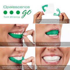 Opalescence detalle de bandejas adaptables resaltando comodidad