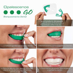 Opalescence bandeja UltraFit detalle que mejora ajuste y confort