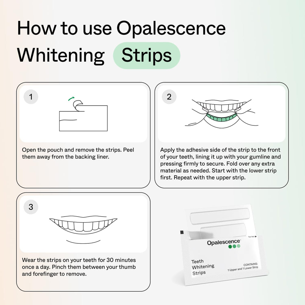 Opalescence uso en sonrisa cotidiana muestra blanqueamiento sin bandeja