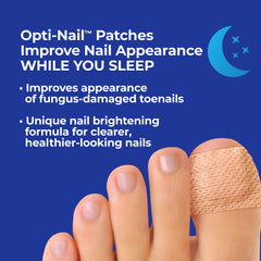 Opti-Nail comparativa antes y después mostrando tono más claro de uñas