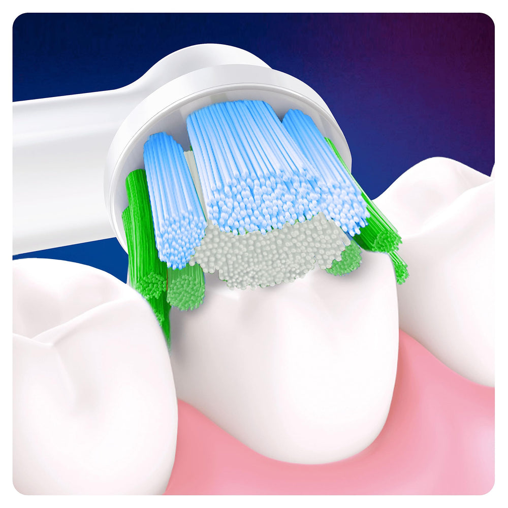 Oral-B cerdas parcialmente decoloradas mostrando cuándo reemplazar