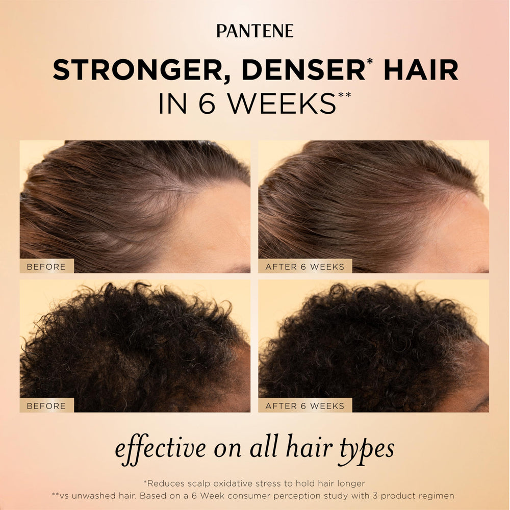 Pantene suero en manos aplicando en línea de raíces para mayor sujeción