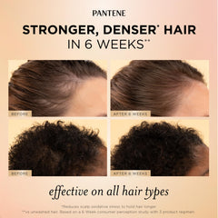 Pantene suero en manos aplicando en línea de raíces para mayor sujeción