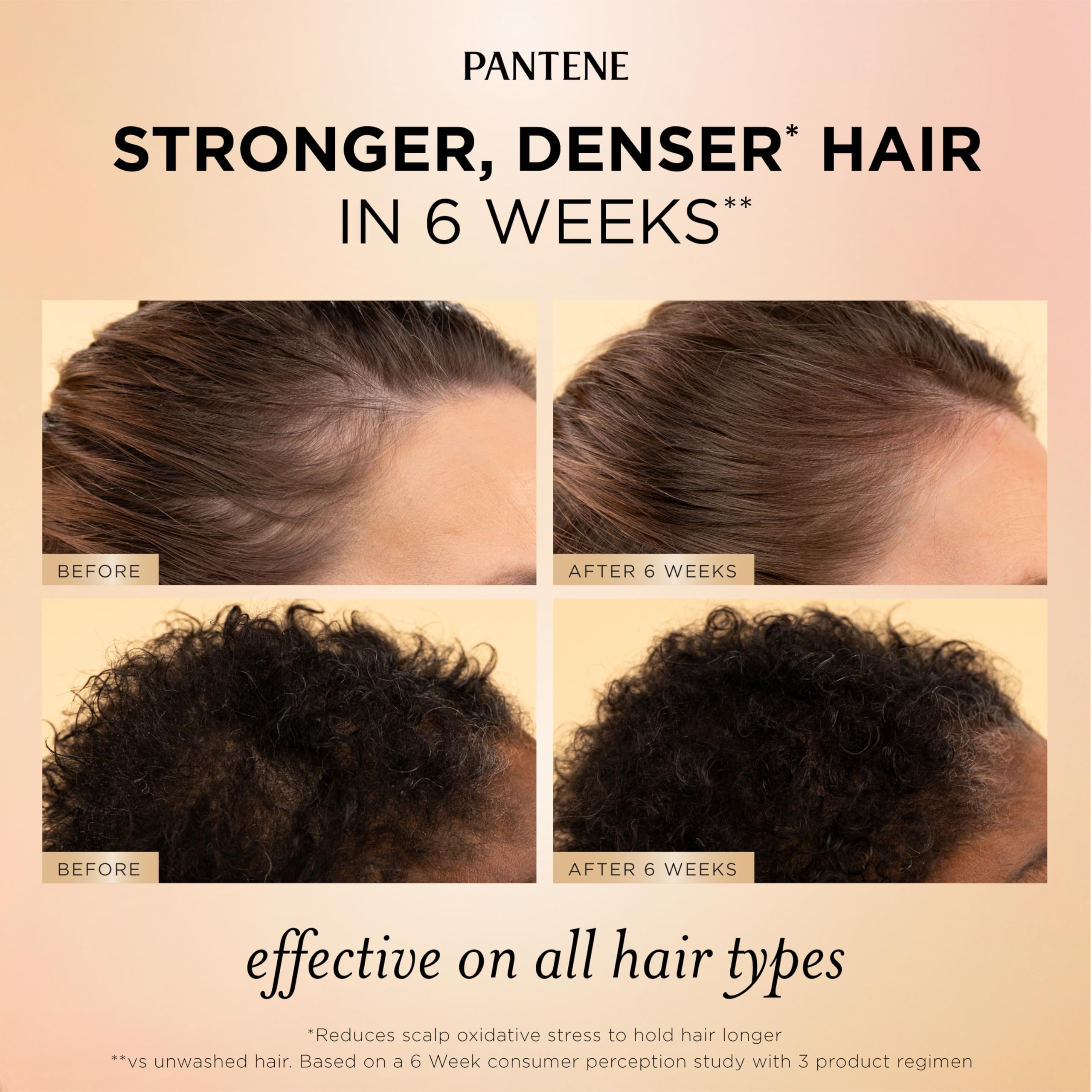 Pantene suero con gotero aplicador para tratamiento localizado del cuero cabelludo