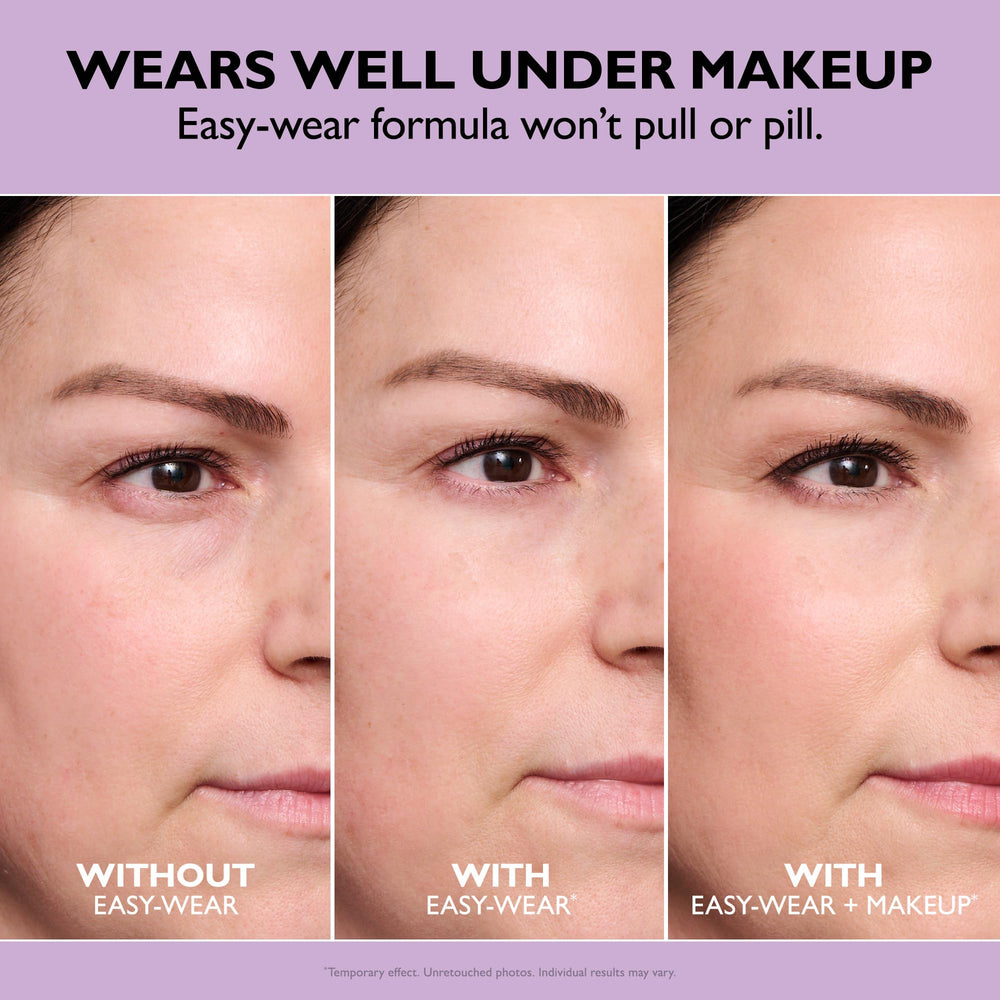 Peter Thomas Roth comparación antes y después mostrando efecto tensante
