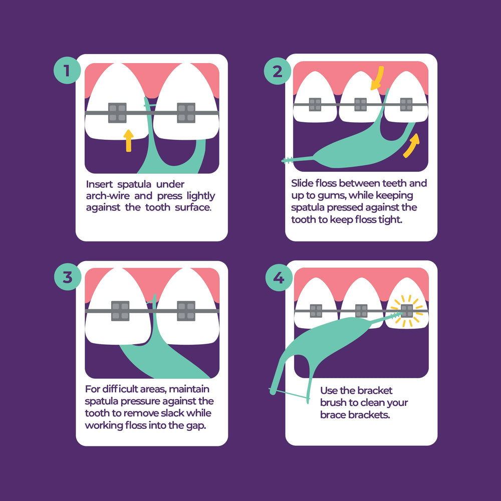 Platypus punta pick en primer plano para retirar restos alrededor de brackets