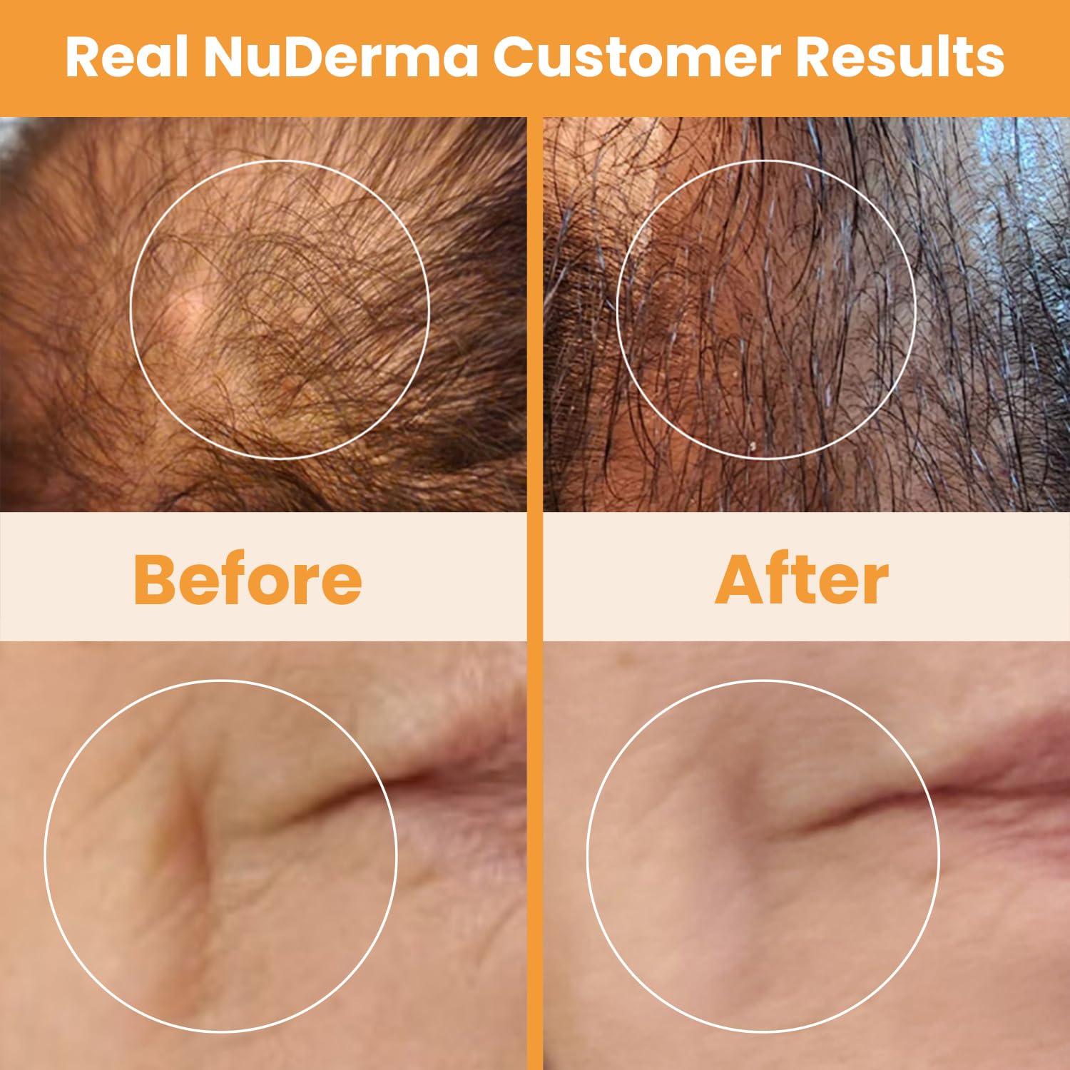 Pure Daily Care NuDerma caja abierta con todos los componentes incluidos