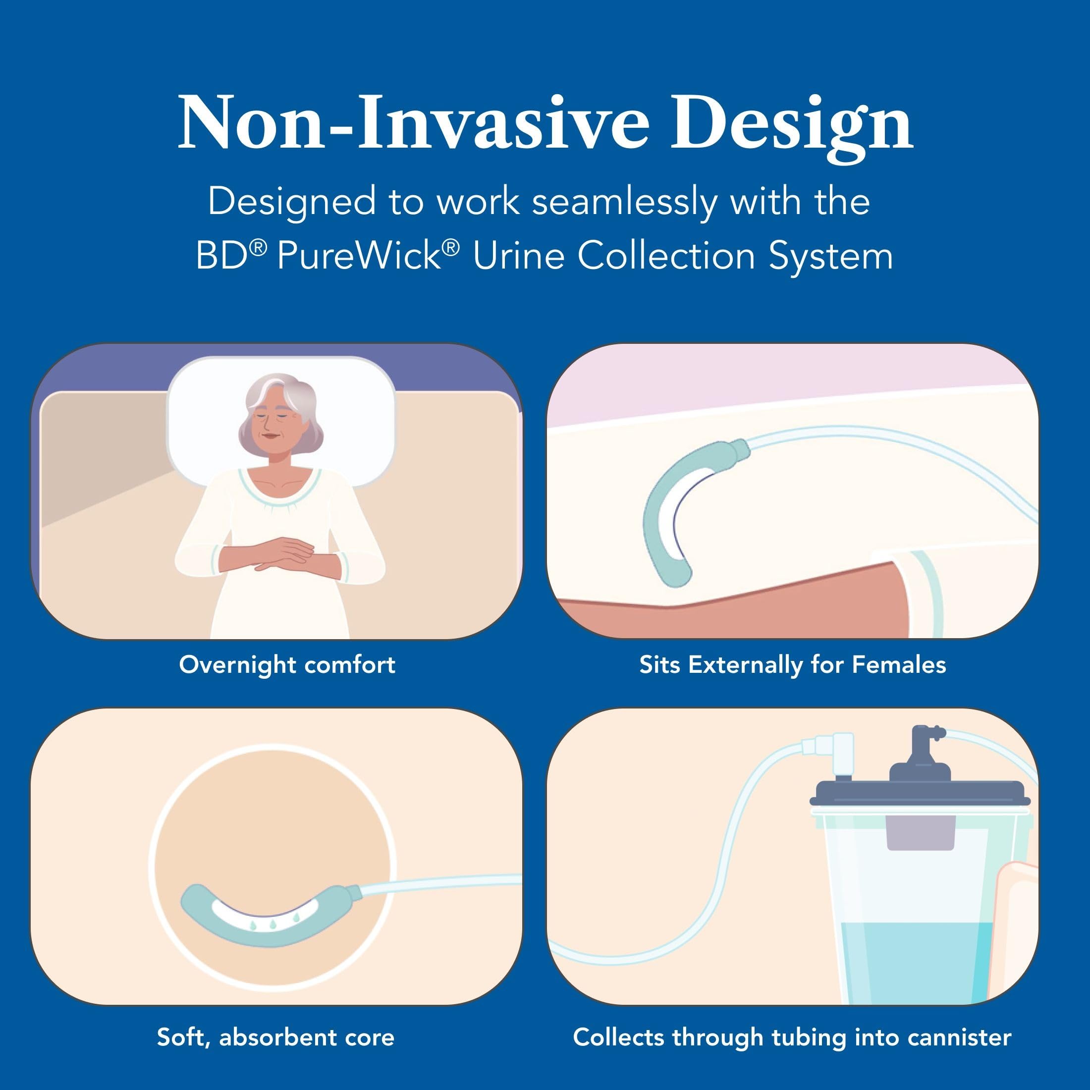 PureWick catéter conectado al sistema ilustrando evacuación no invasiva