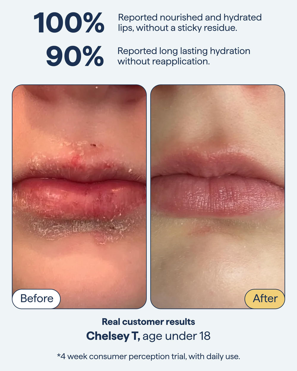 Remedy Science aplicación en labios para reparación y sellado
