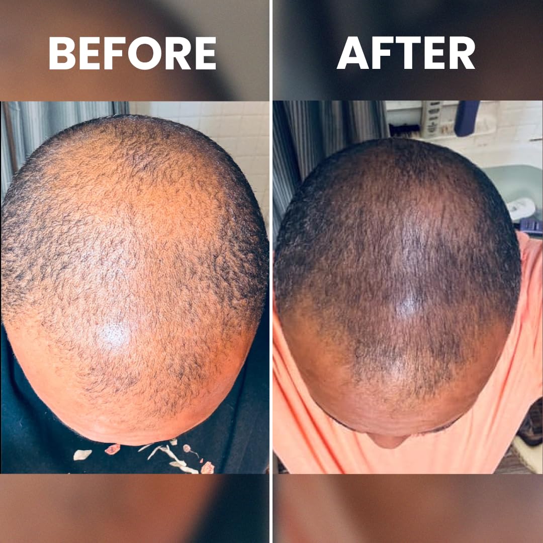 Rennora Beauty frasco en mano para comparar tamaño y desplazamiento fácil.