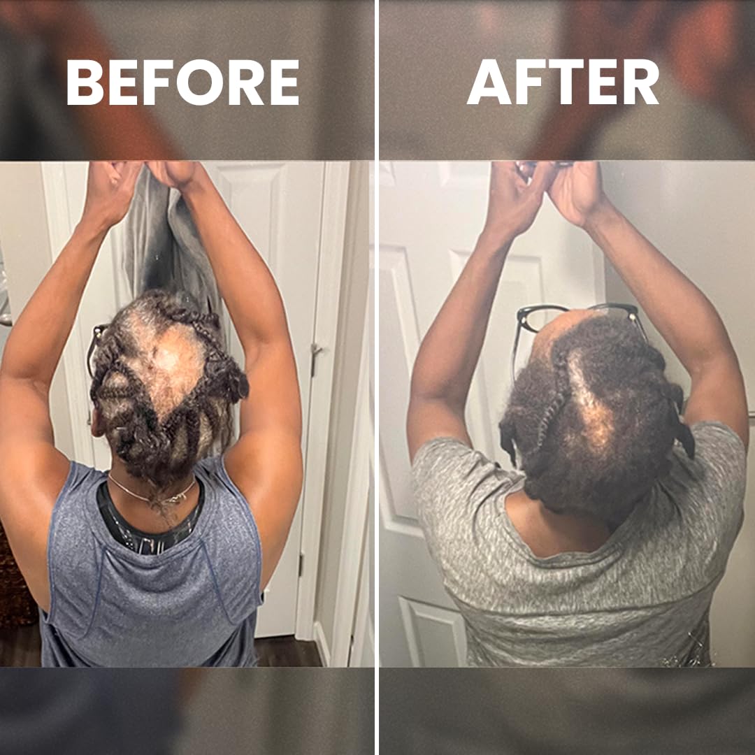 Rennora en estilo de vida con peinado rizado mostrando resultado saludable