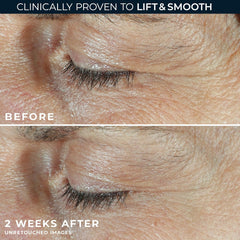 RoC textura crema blanca extendida, hidratación y alivio para la zona inferior del ojo