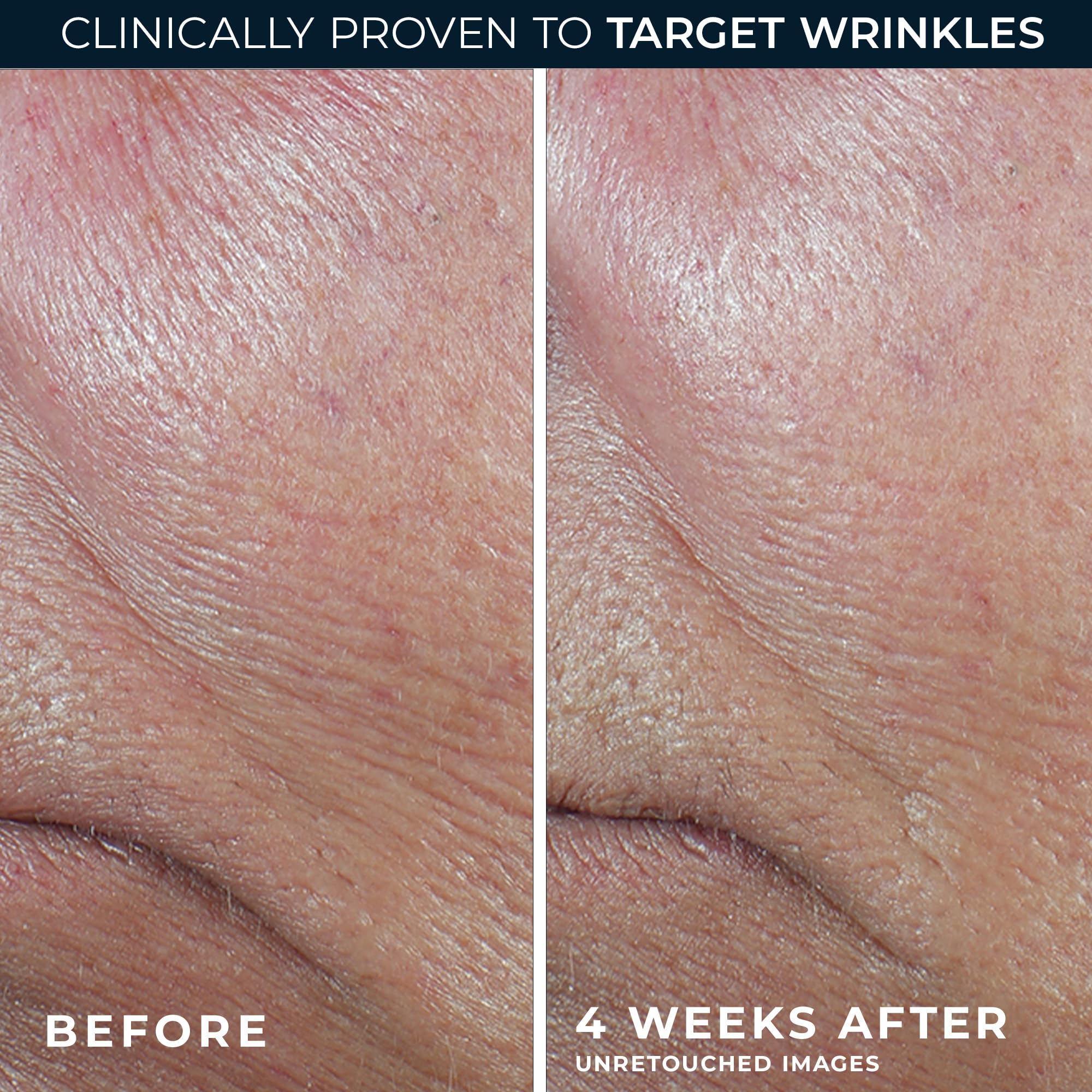 RoC etiqueta con ingredientes principales que destaca retinol y antioxidantes