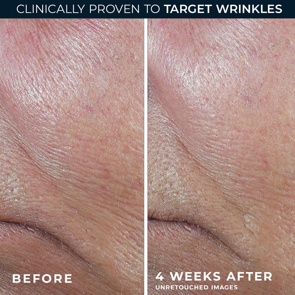 RoC etiqueta con ingredientes principales que destaca retinol y antioxidantes