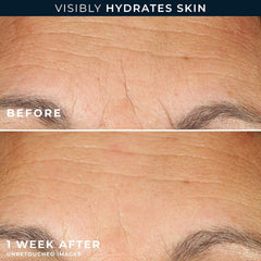 RoC empaque de cápsulas de retinol mostrando la prueba de 7 días