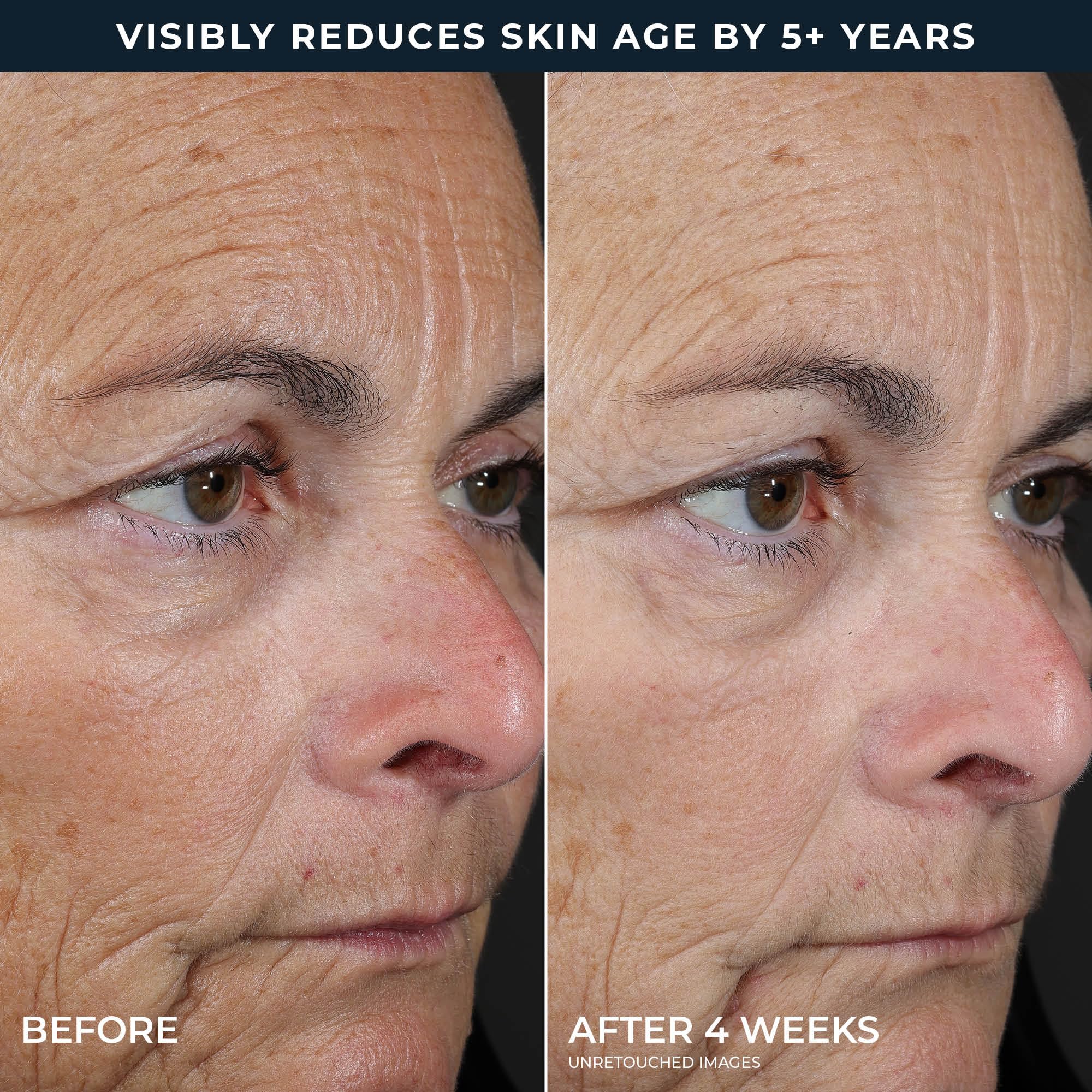 RoC etiqueta de ingredientes con retinol clínico y mezcla de ácidos