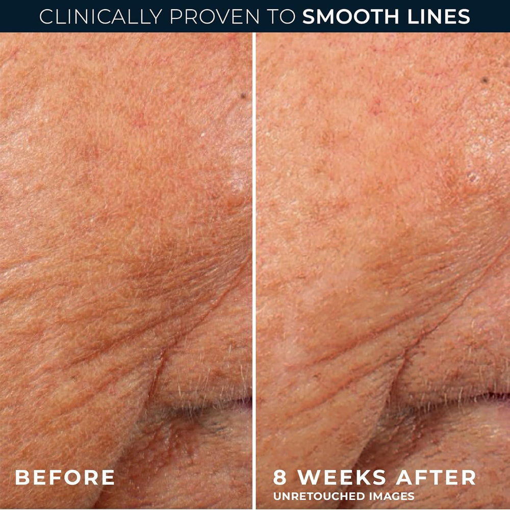 RoC product label close-up showing retinol and ceramides for skin support