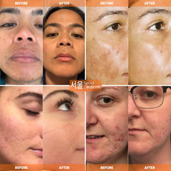 SeoulCeuticals etiqueta con ingredientes activos que aporta transparencia