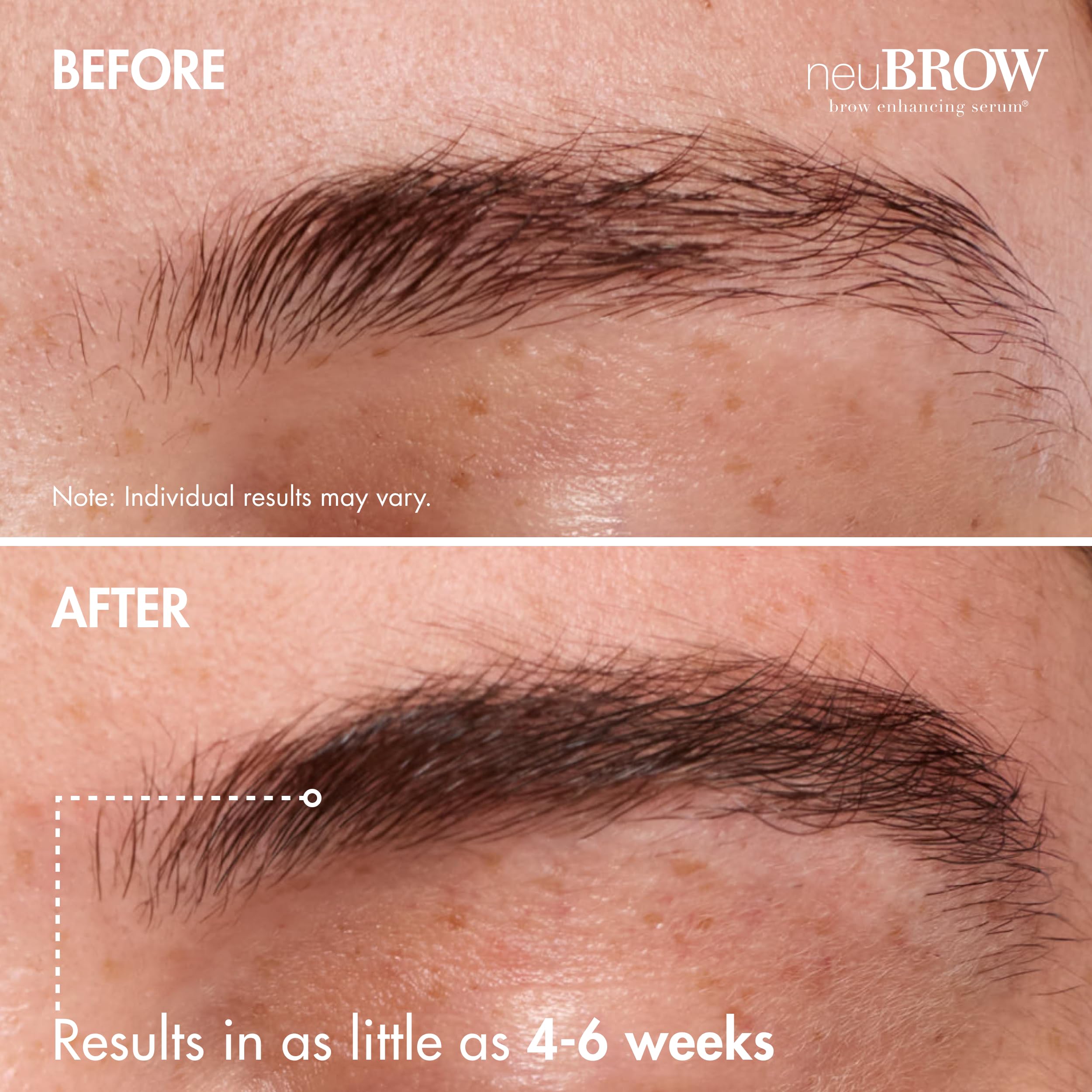 Skin Research Laboratories neuBROW imagen antes y después cejas más densas