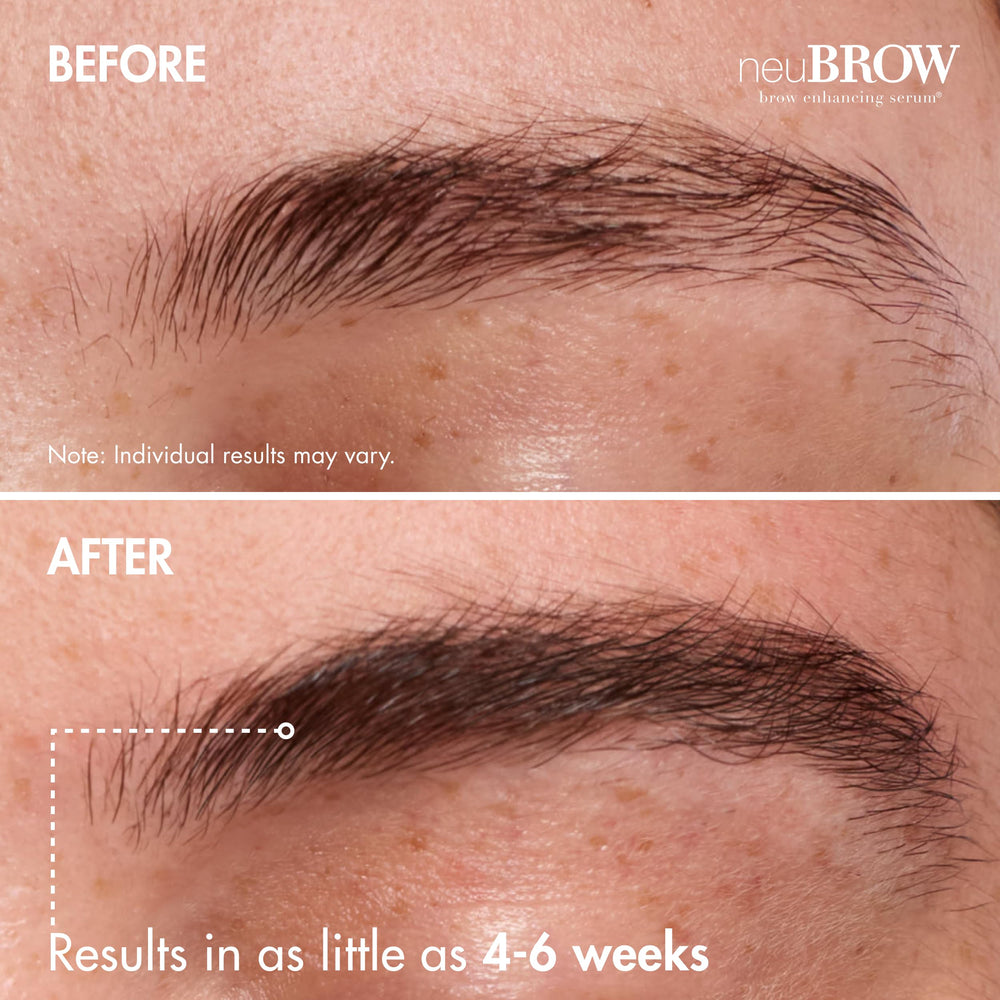 Skin Research Laboratories neuBROW imagen antes y después cejas más densas