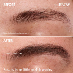 Skin Research Laboratories neuBROW imagen antes y después cejas más densas