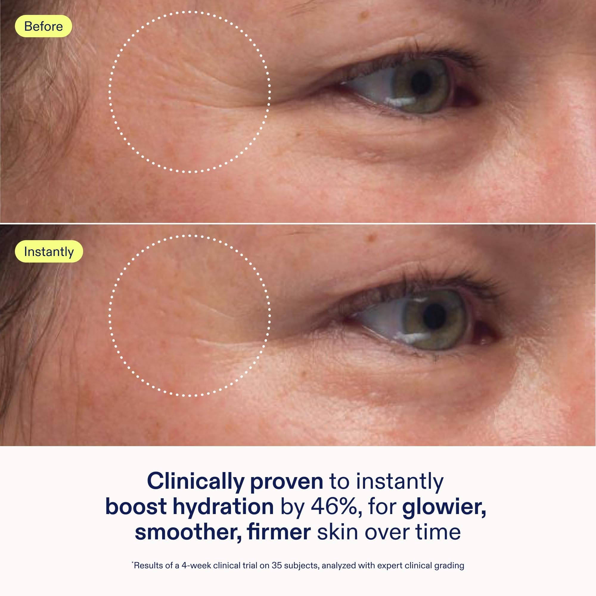 Skinfix crema aplicada por mujer en mañana y noche para rutina equilibrada