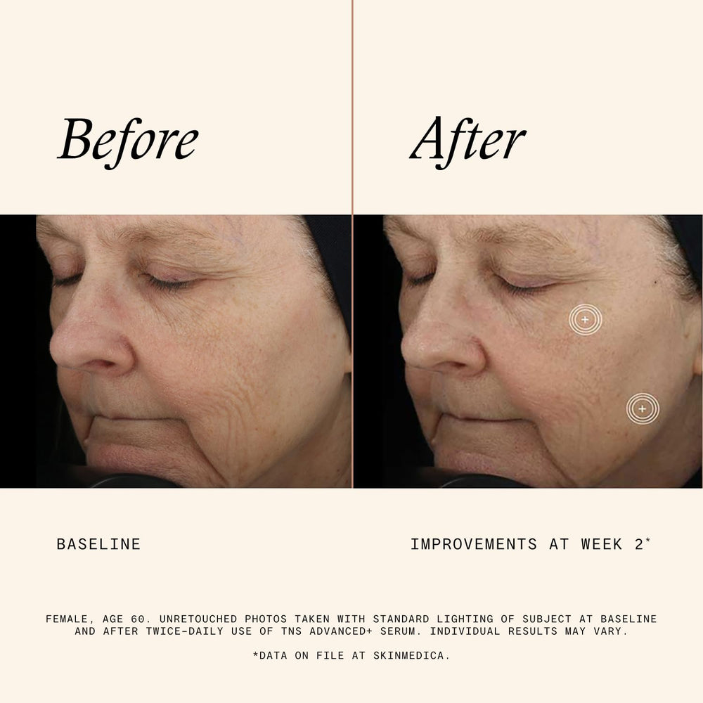 SkinMedica aplicación del suero en manos para nutrición instantánea