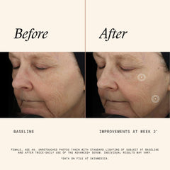SkinMedica aplicación del suero en manos para nutrición instantánea