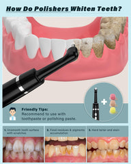 Smile-Aid primer plano del cabezal de silicona para eliminar manchas difíciles