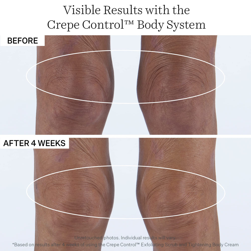 StriVectin estilo de vida con piernas lisas y tono más uniforme