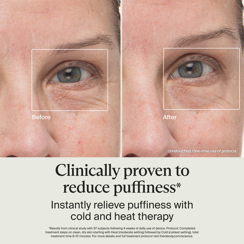 TheraFace aplicando en contorno de ojos para reducir bolsas y mejorar mirada