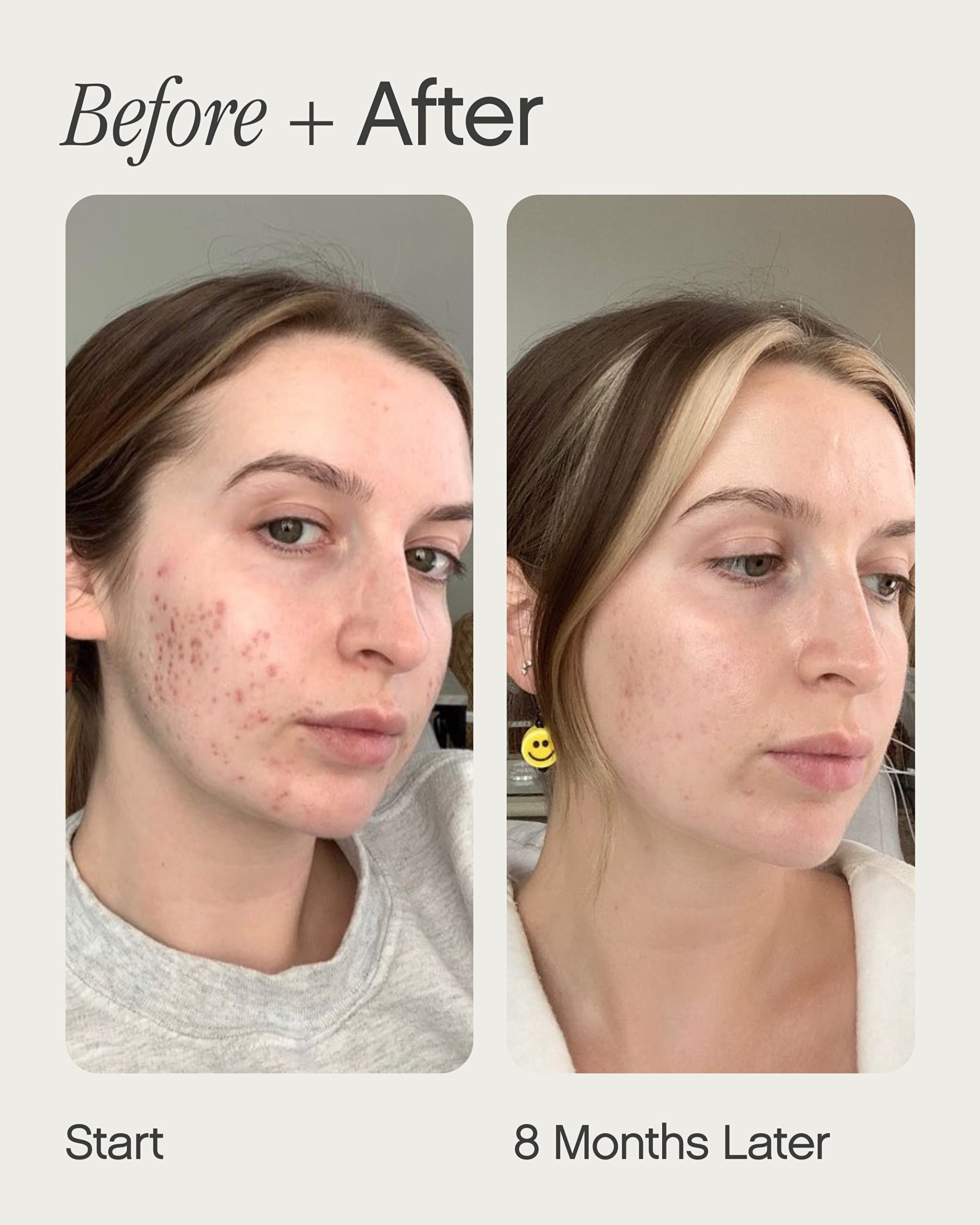 Topicals suero aplicado en rostro mostrando efecto calmante
