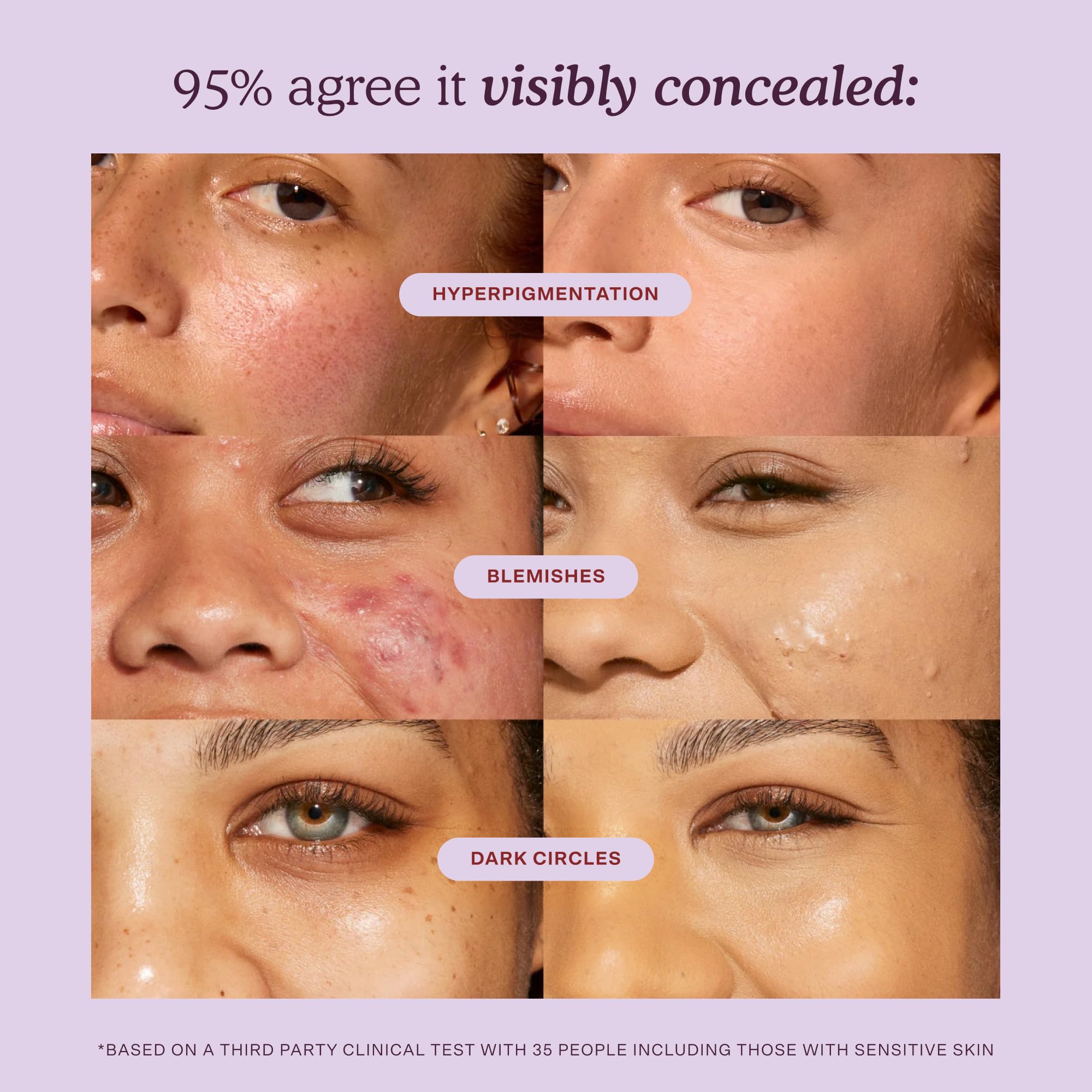 Tower 28 concealing a blemish for natural-looking coverage