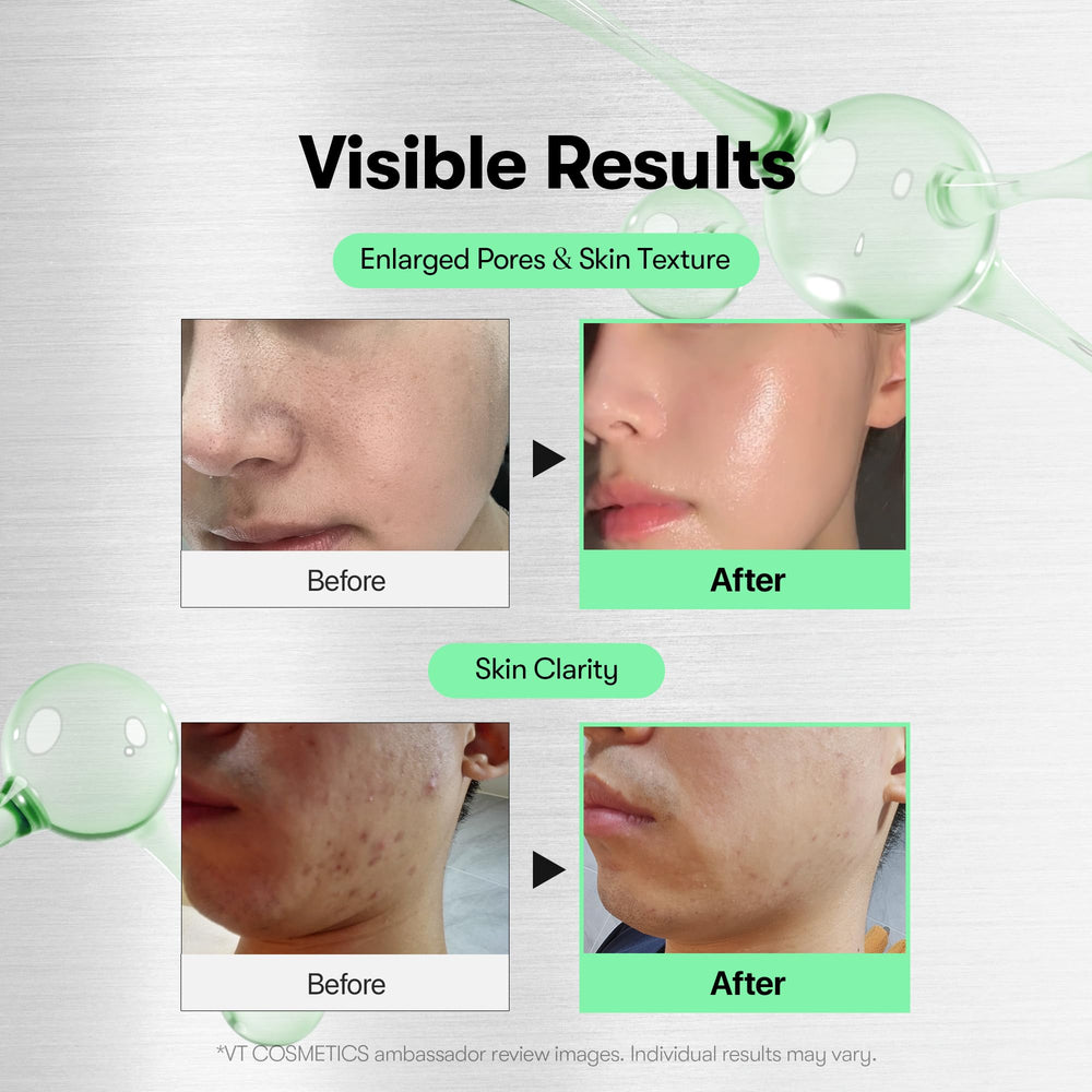 VT COSMETICS aplicación del Reedle Shot en la mano para rutina rápida