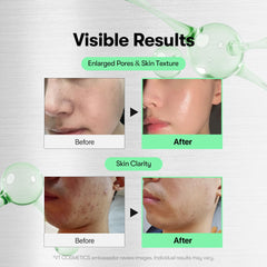 VT COSMETICS aplicación del Reedle Shot en la mano para rutina rápida