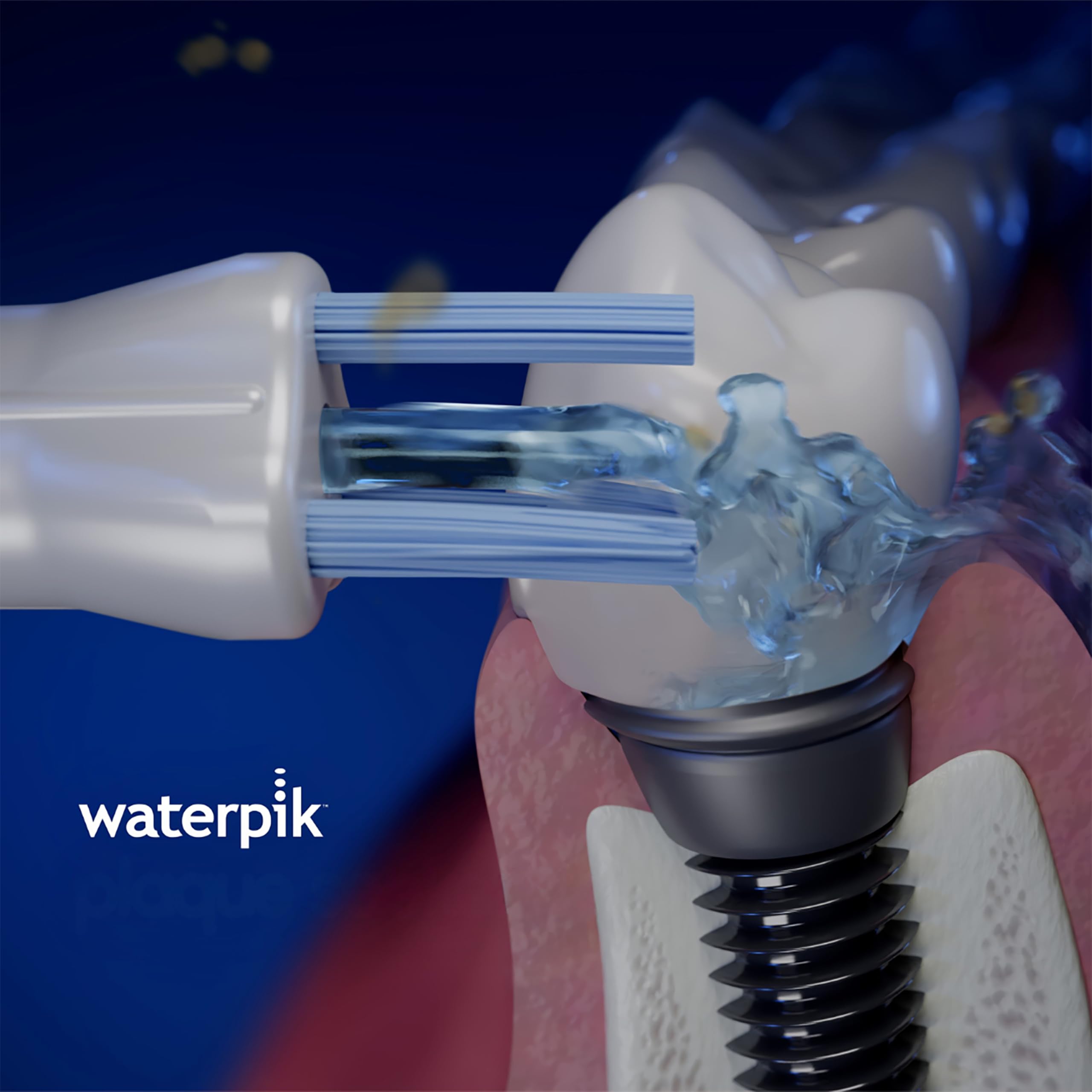 Waterpik comparación de tamaño Plaque Seeker mostrando escala y ergonomía