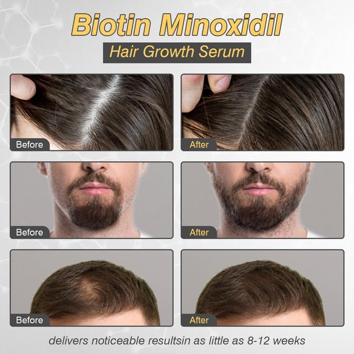YKDILYHH etiqueta con información de minoxidil 5% y beneficios de biotina